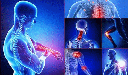 ozonoterapia contro fibromialgia